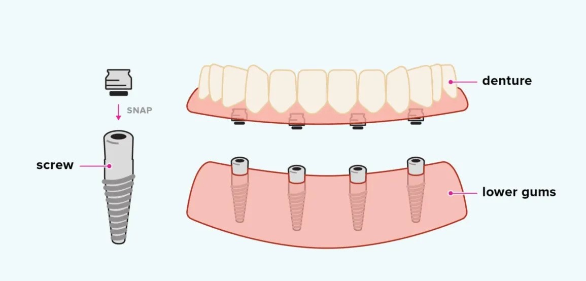 Patient receiving dental treatments