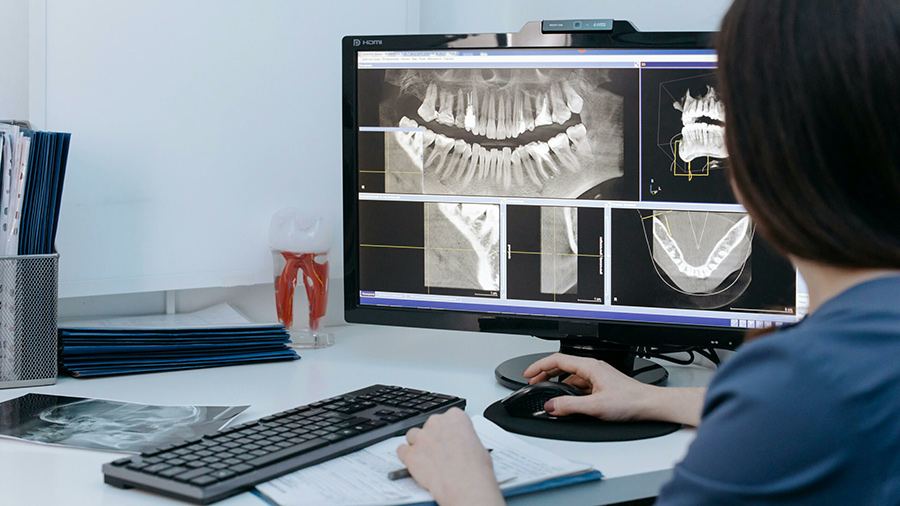 dentist reviewing x-rays on a computer