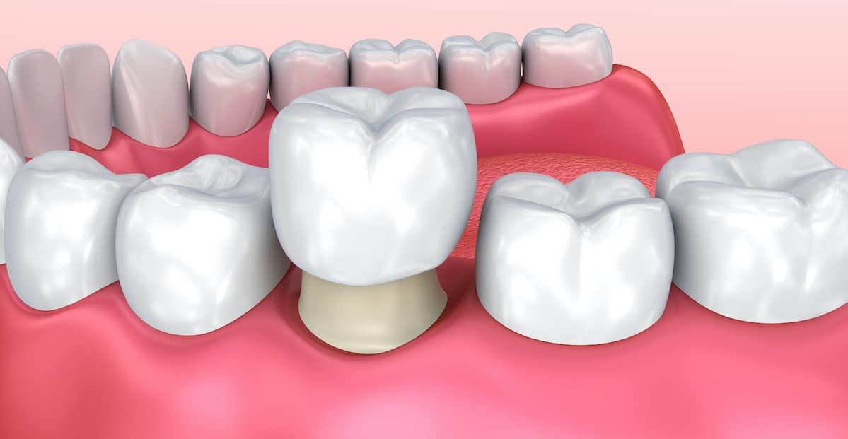 Patient receiving dental treatments